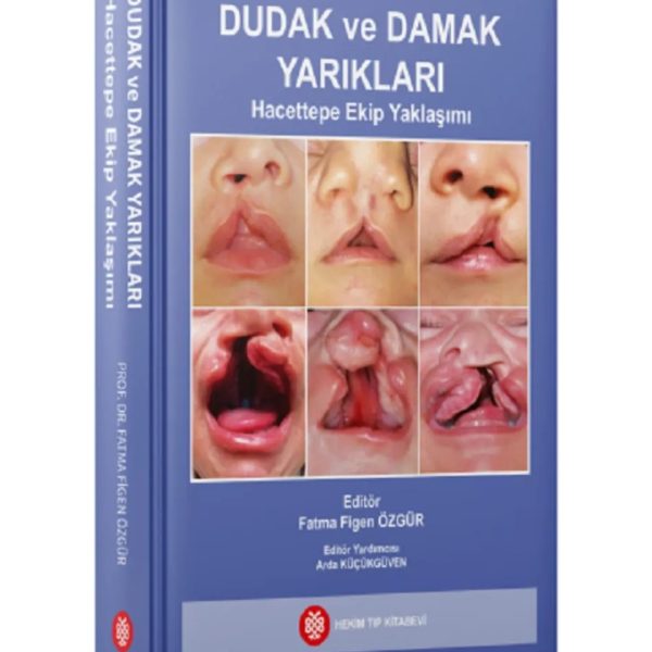 Dudak ve Damak Yarıkları Hacettepe Ekip Yaklaşımı – Fatma Figen Özgür